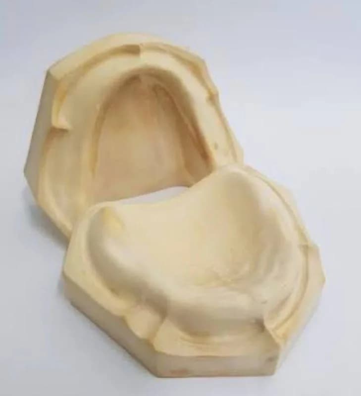 Edentlous Cast (Upper & Lower)